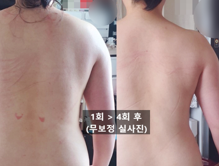 르마망산전산후케어 이미지