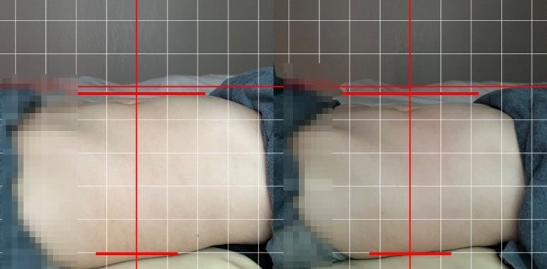 르마망산전산후케어 이미지