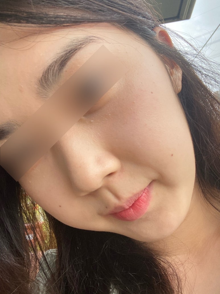 맑은참피부과의원 이미지