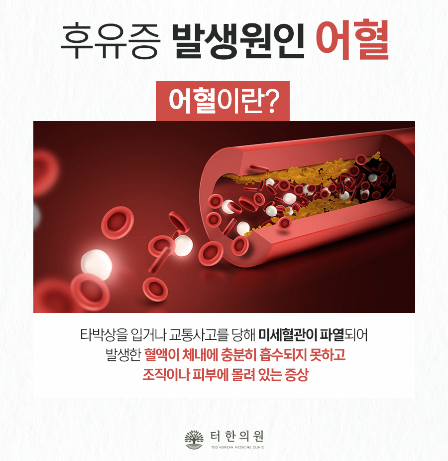 터한의원 이미지