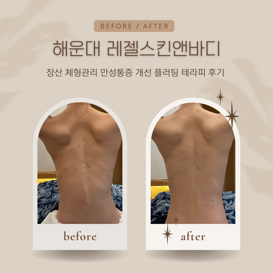 플러팅테라피 이미지
