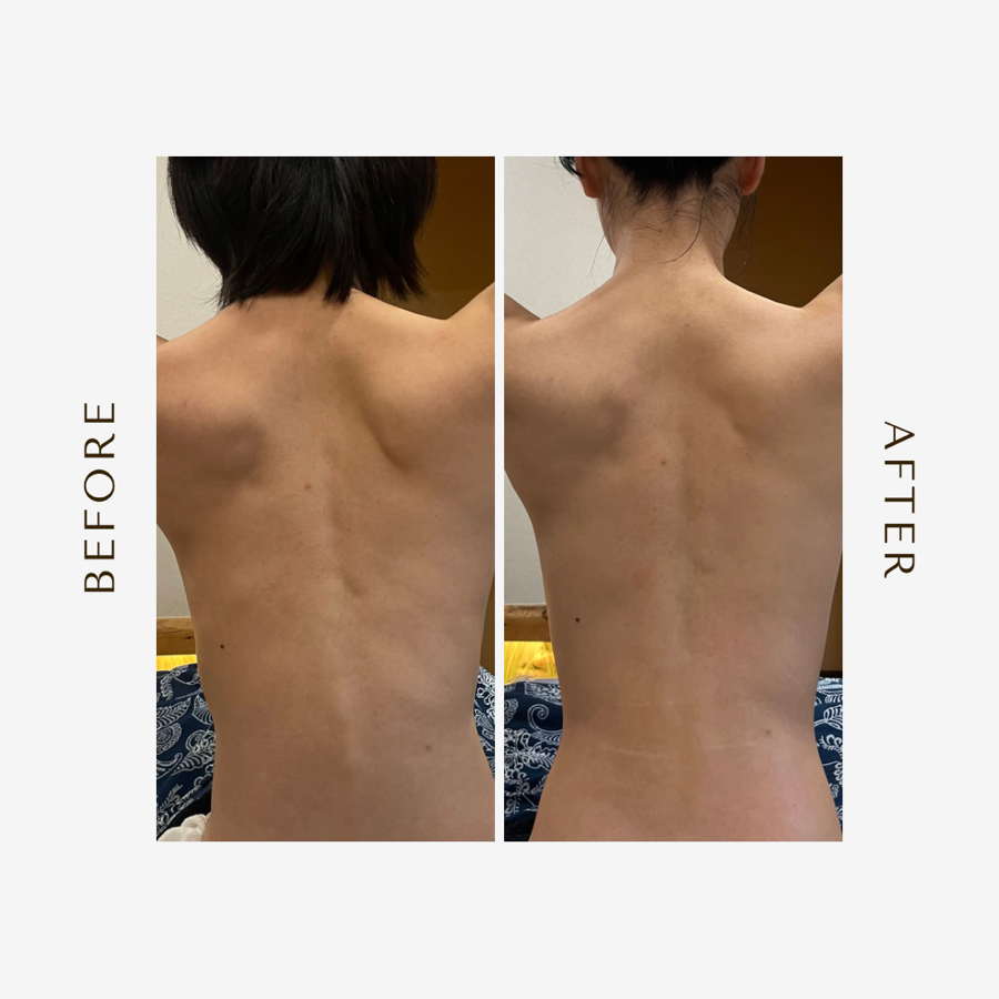 플러팅테라피 이미지