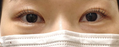 아이포유 이미지