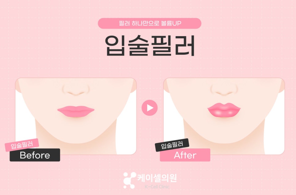 케이셀의원 이미지