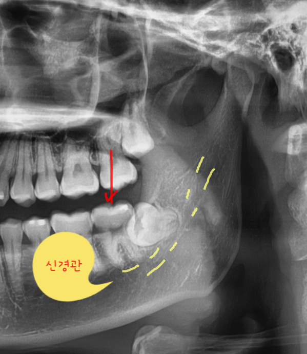 민플란트치과의원 이미지