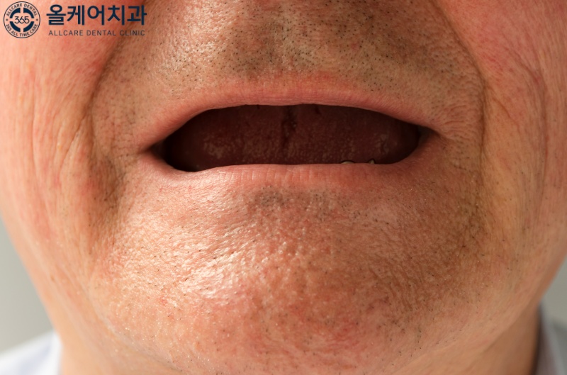 365올케어치과의원 이미지