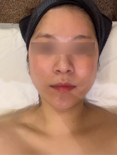 세르모소에스테틱 이미지