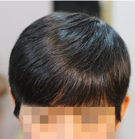 현대가발 이미지