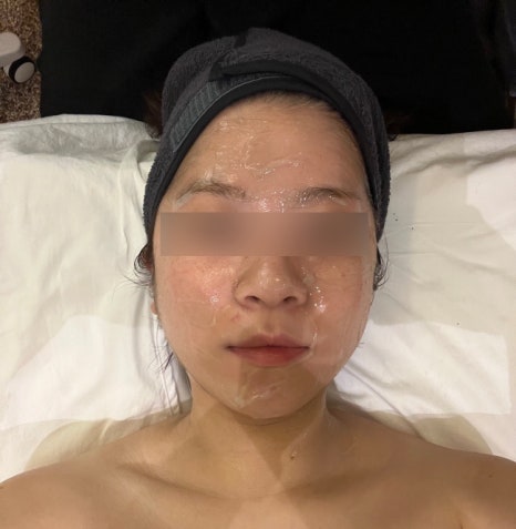 세르모소에스테틱 이미지