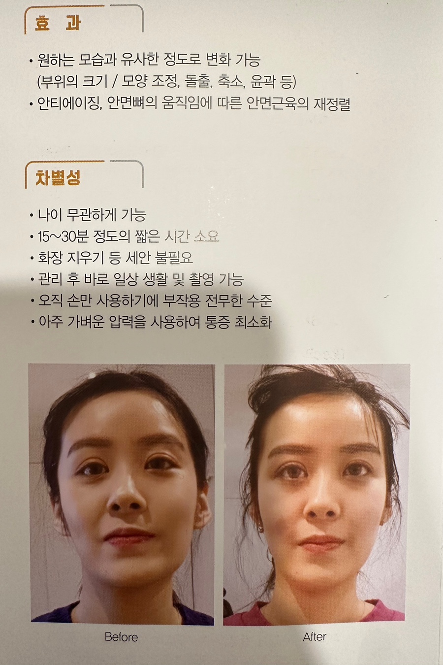 보나트페이스 이미지