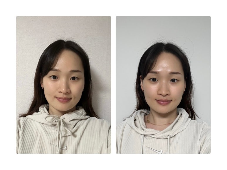 클라라 에스테틱 이미지