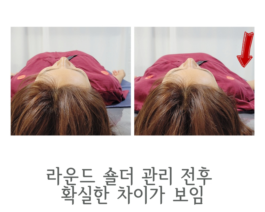 공영토탈 이미지