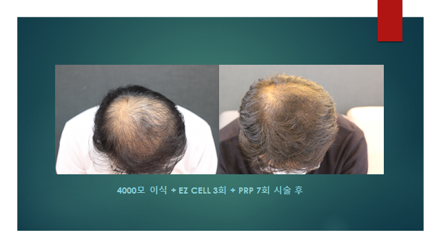 이지성형외과 이미지