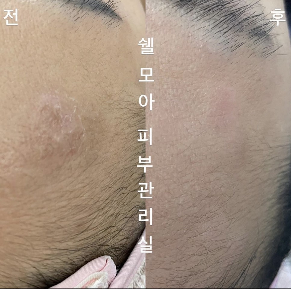 쉘모아 피부관리실 이미지