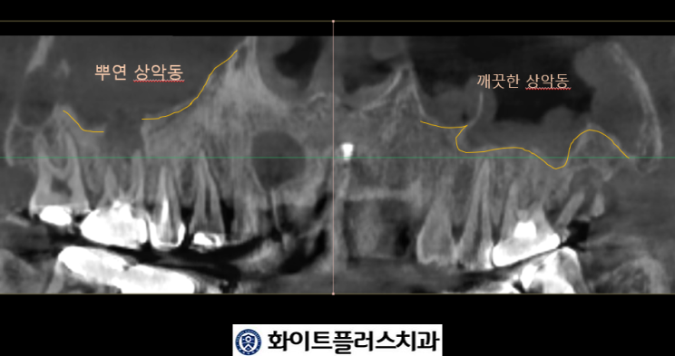 화이트플러스치과 이미지