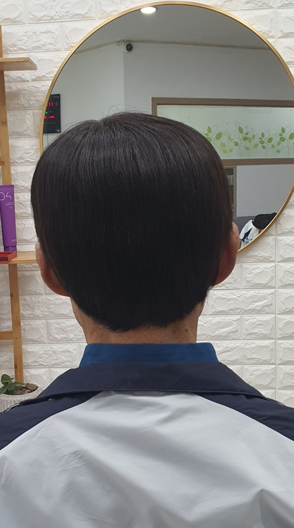 전주동안가발 이미지