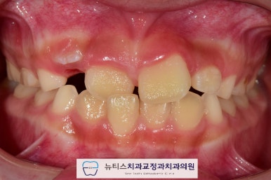 뉴티스치과교정과치과의원 이미지