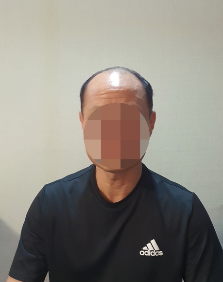 전주동안가발 이미지