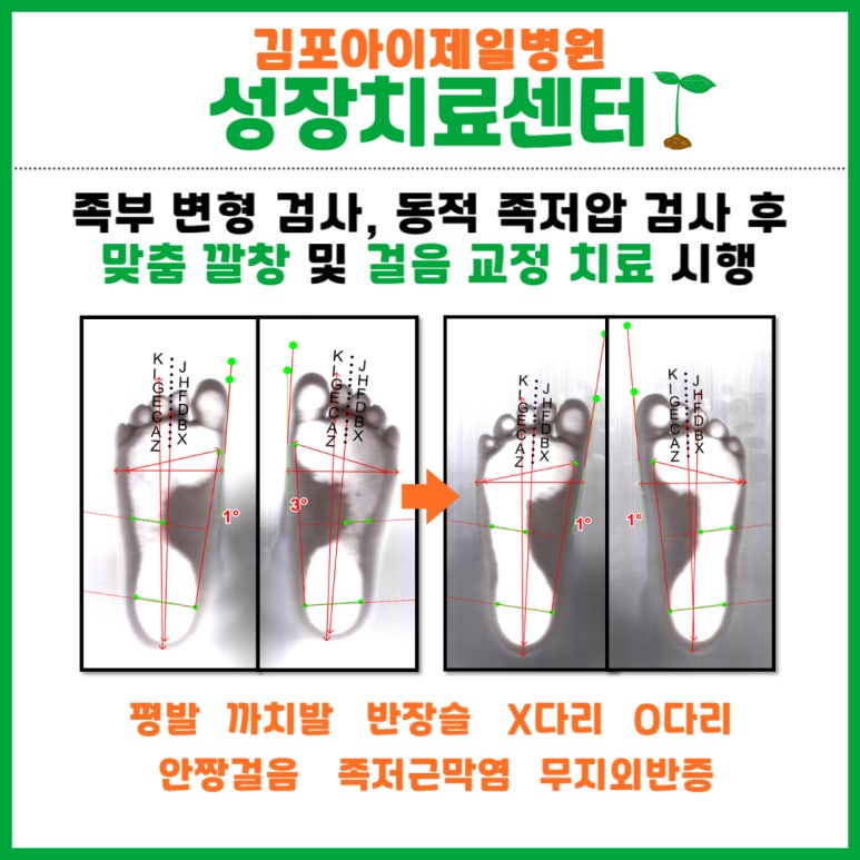 바른자세교정센터 이미지