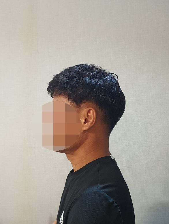 전주동안가발 이미지