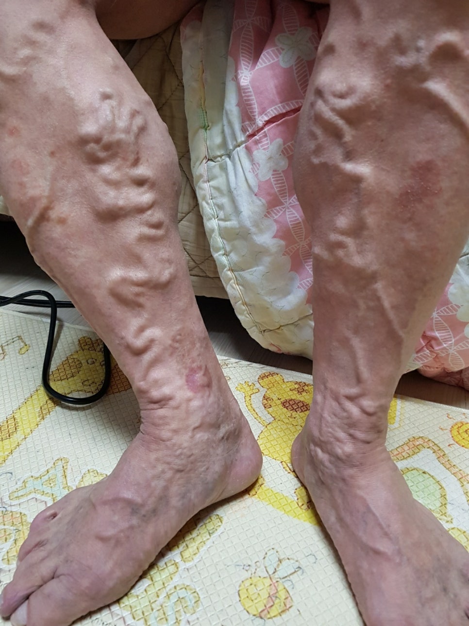 리얼클린 이미지