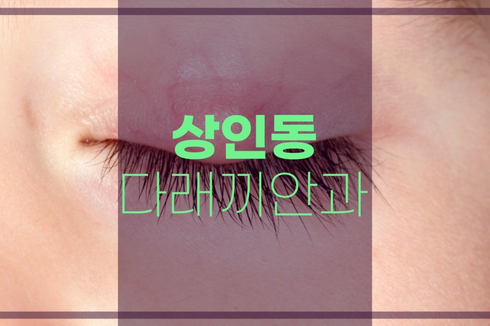 로운안과의원 이미지