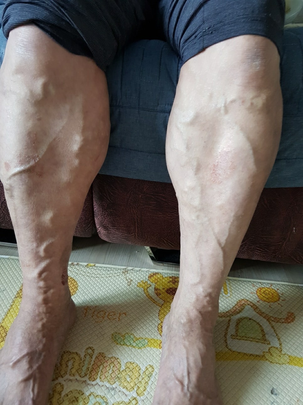 리얼클린 이미지