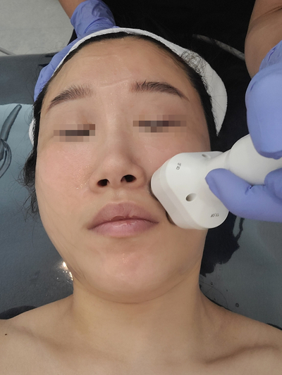 오투(O2)산소테라피 이미지