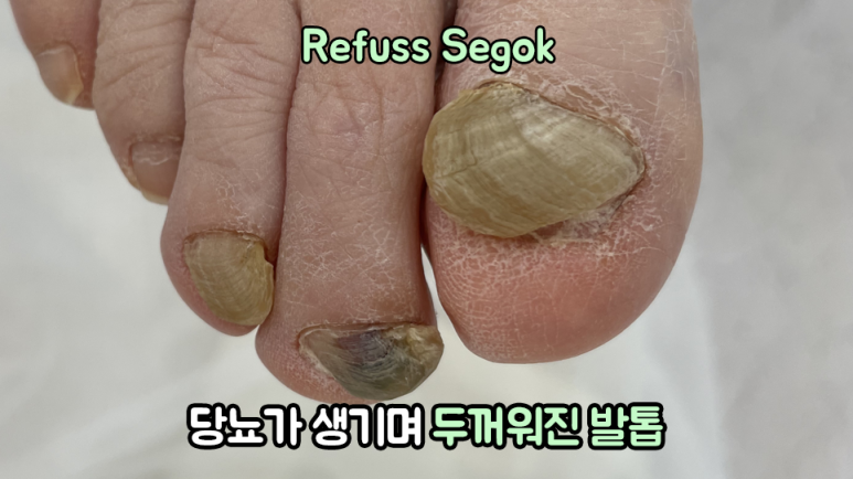 레푸스강남세곡점 이미지