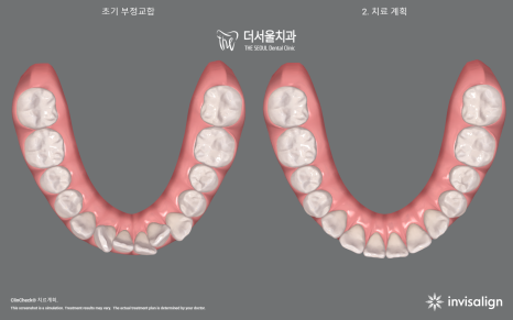 서울더좋은치과 이미지