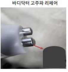 고주파 리페어 이미지