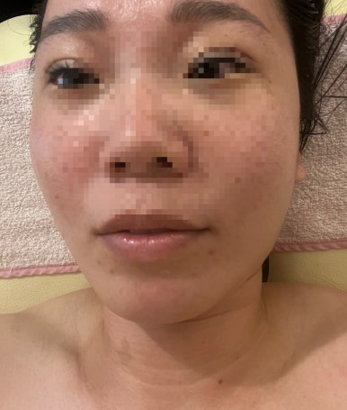 란에스테틱 이미지