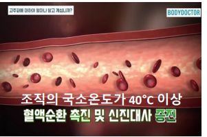 고주파 리페어 이미지