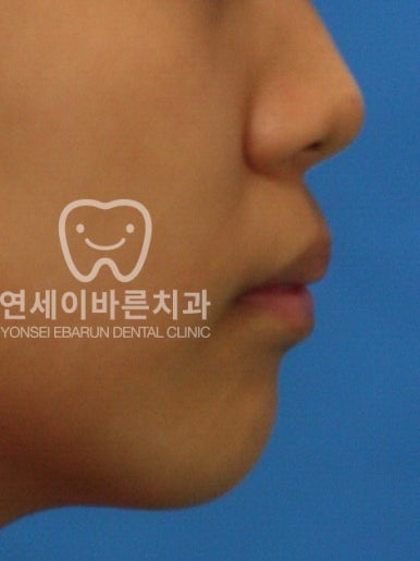 연세진치과 이미지