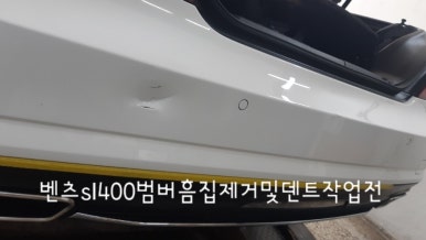 에이스덴트마스터 이미지