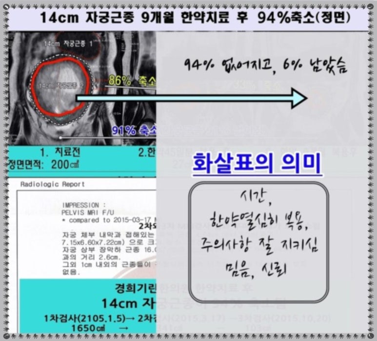 경희전문주 이미지