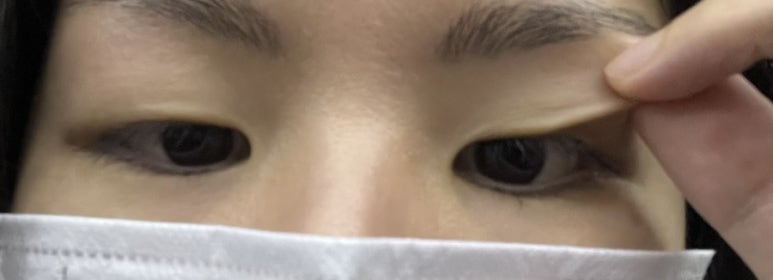리트머스성형외과 이미지