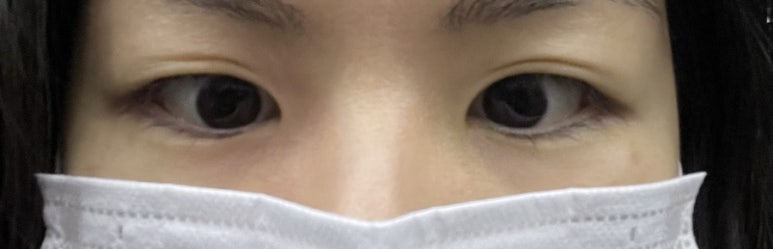 리트머스성형외과 이미지