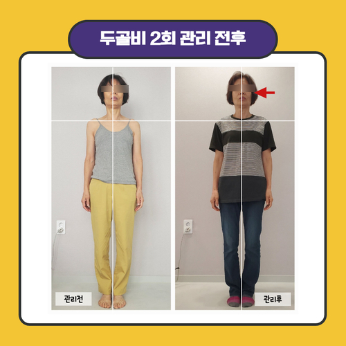 가벼움바른체형 이미지