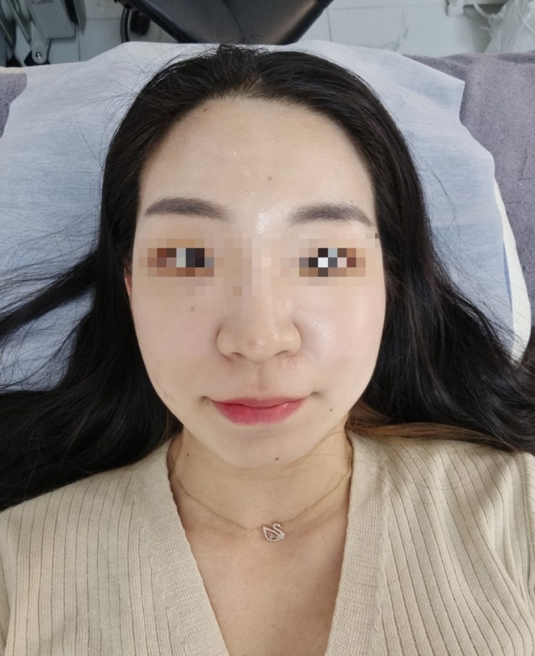 비니래쉬앤뷰티 이미지