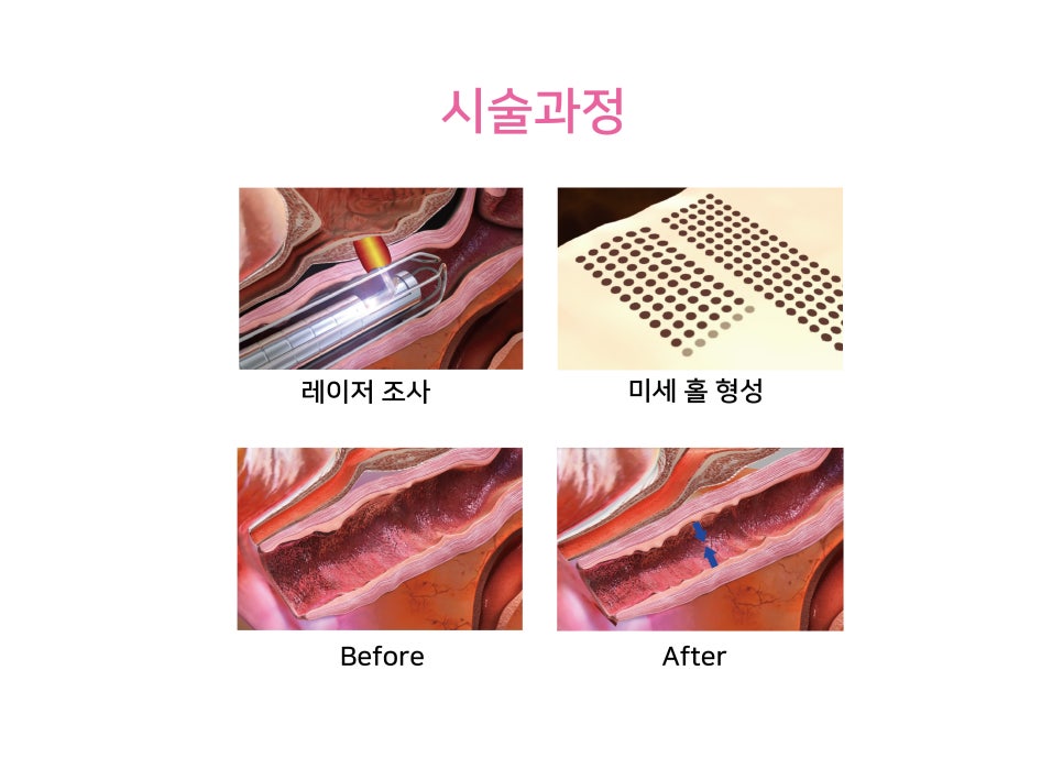 리안산부인과 이미지