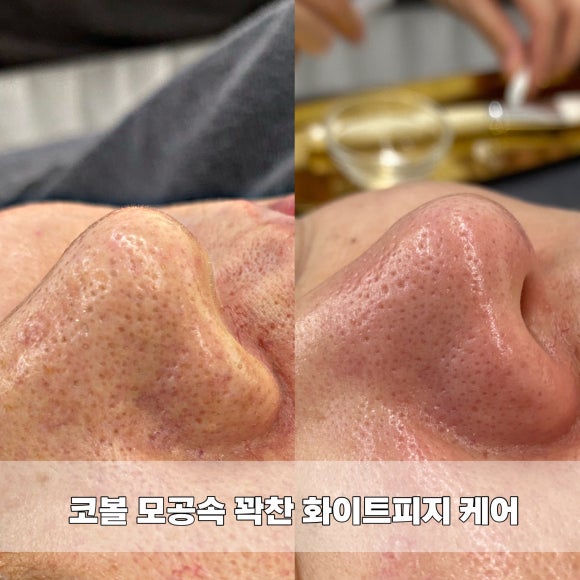 바이밍 이미지