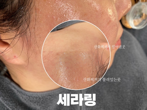 바이밍 이미지