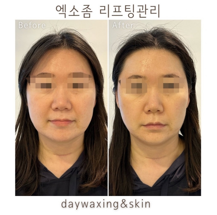 왁싱데이스킨케어 이미지