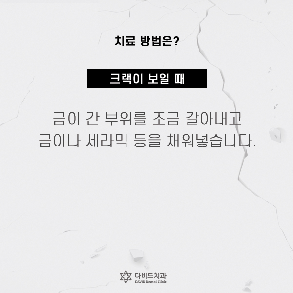 다비드치과 이미지