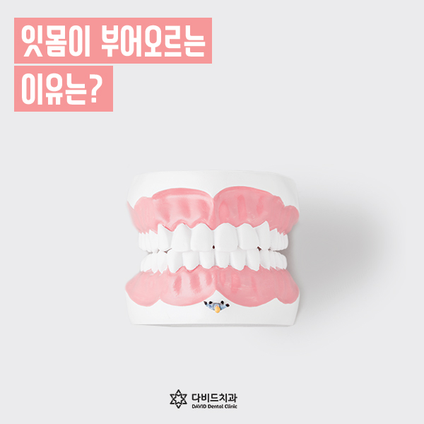 다비드치과 이미지