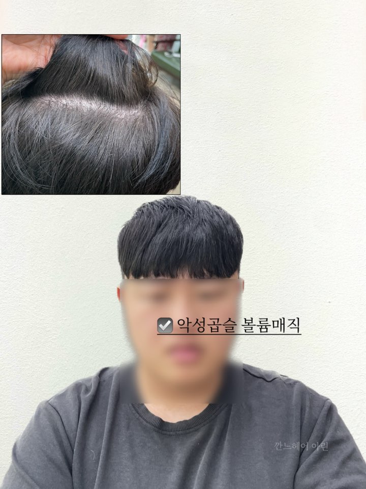깐느헤어 이미지