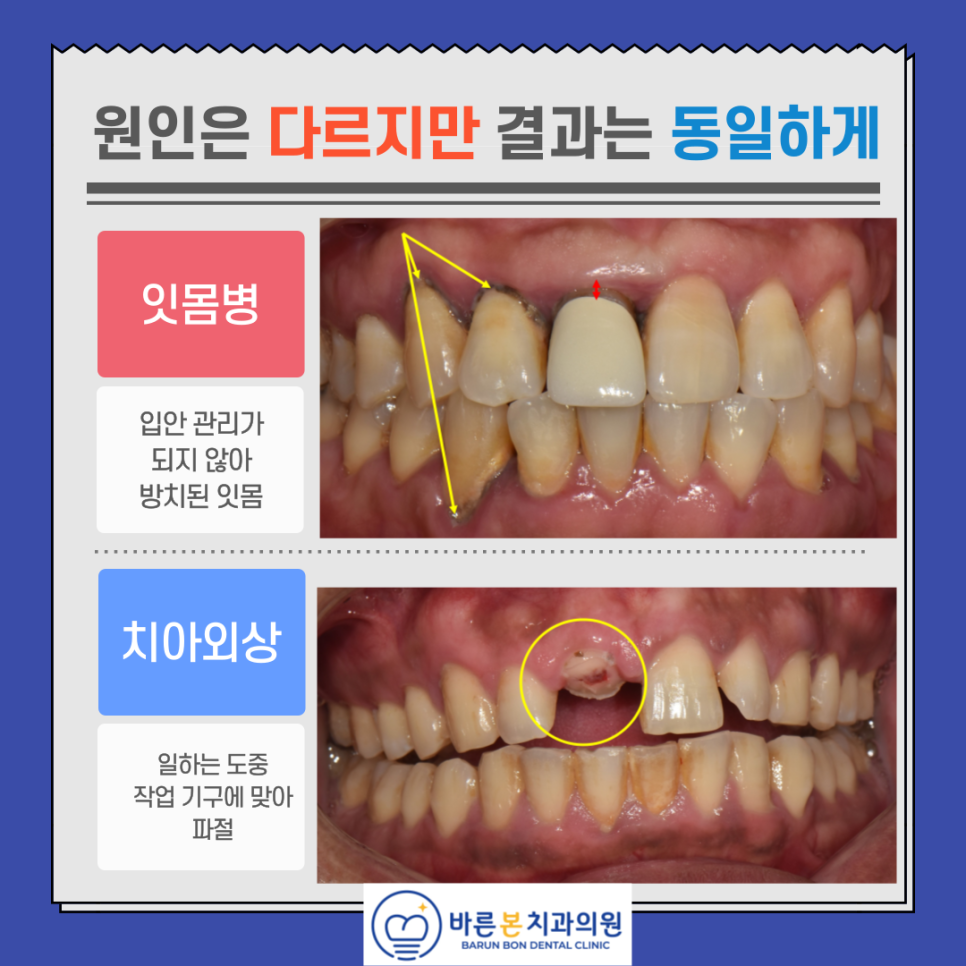 하하하치과의원 이미지