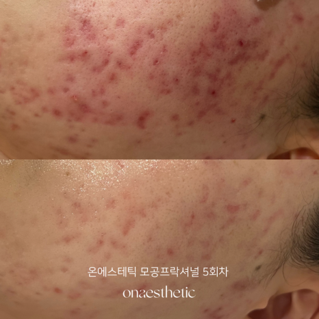 온:피부미용아카데미학원 이미지