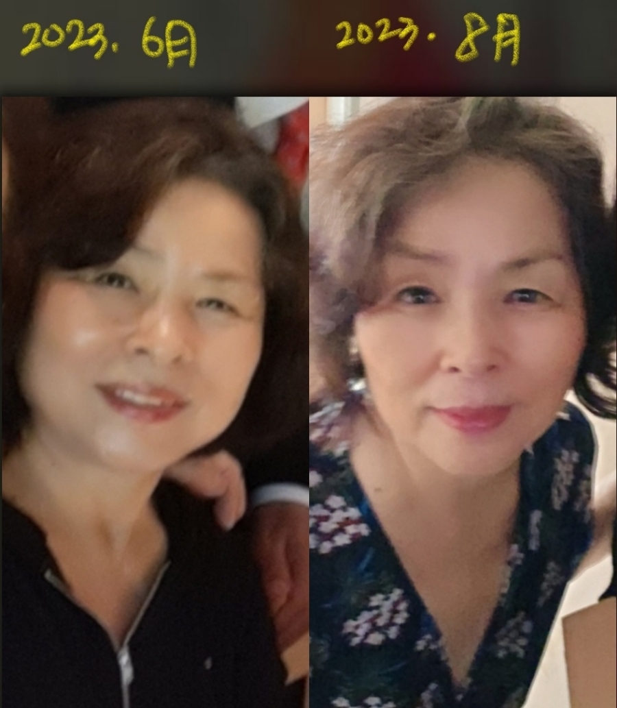 터치클린 이미지